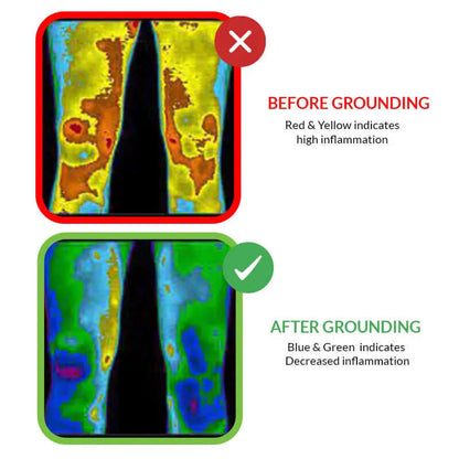 Universal Grounding Mat Kit